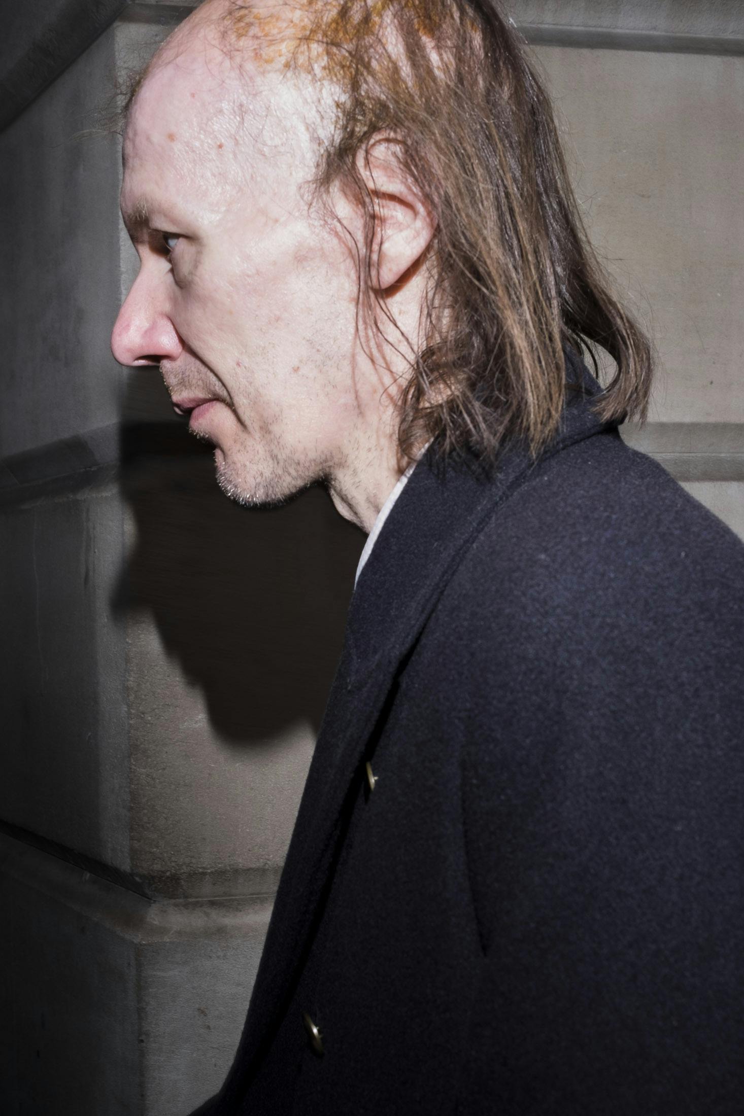 Man with hair loss walking in Bank, London.